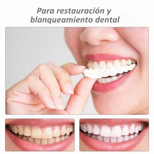 Carillas Dentales HappySmile®