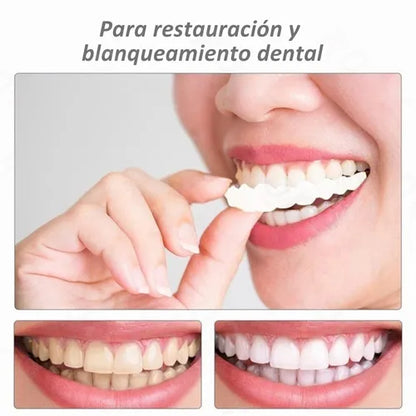 Carillas Dentales HappySmile®