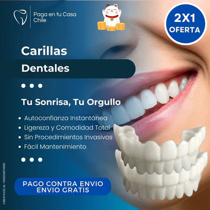 Carillas Dentales HappySmile®